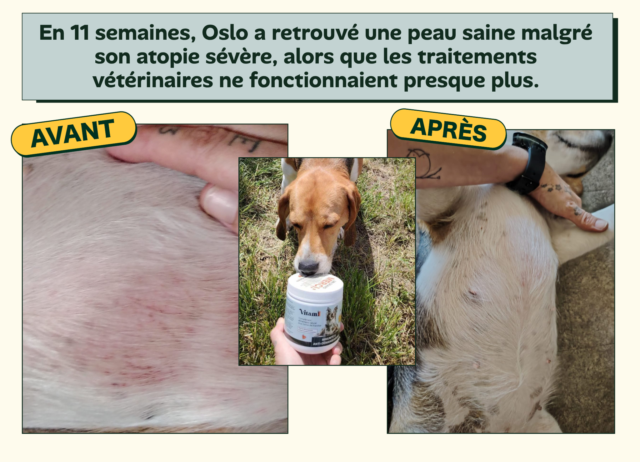 Avant/apres Oslo - peau saine apres atopie severe